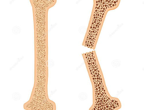 Le strontium, un supplément efficace pour la prévention de l’ostéoporose