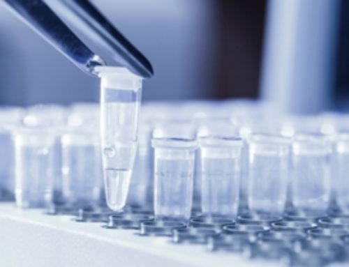 Test salivaire disponible à la boutique Anti-Âge